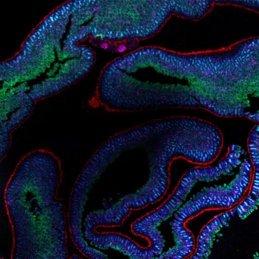 Composite spatial molecular image of intestine tissue