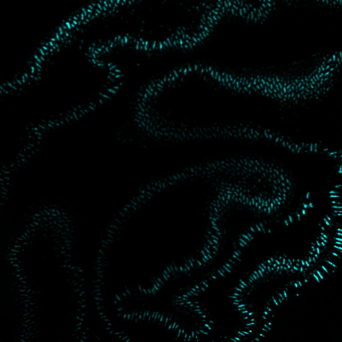 IGHA expression in the same intestine tissue section